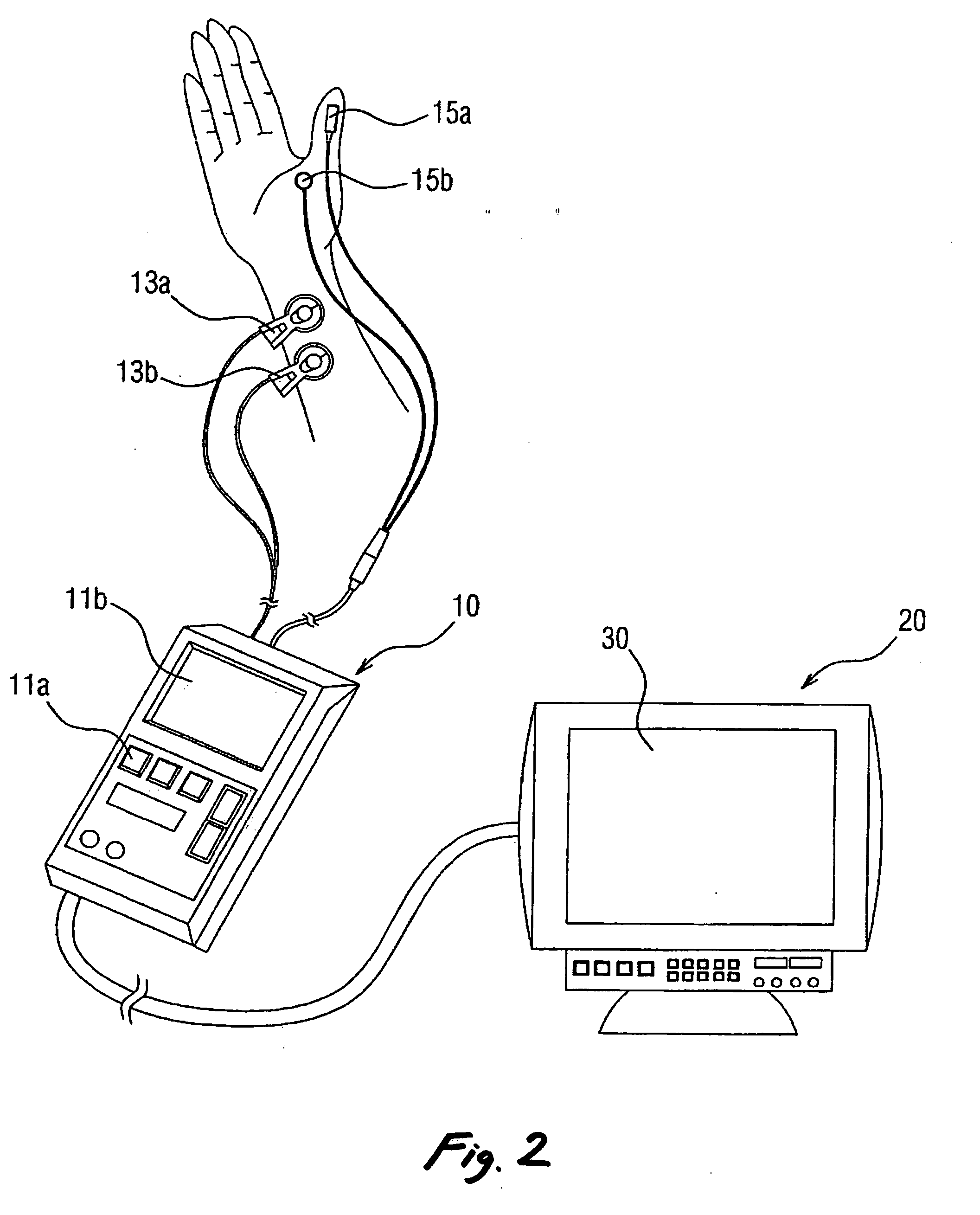 Method and monitor apparatus for displaying parameters indicative of muscle relaxation