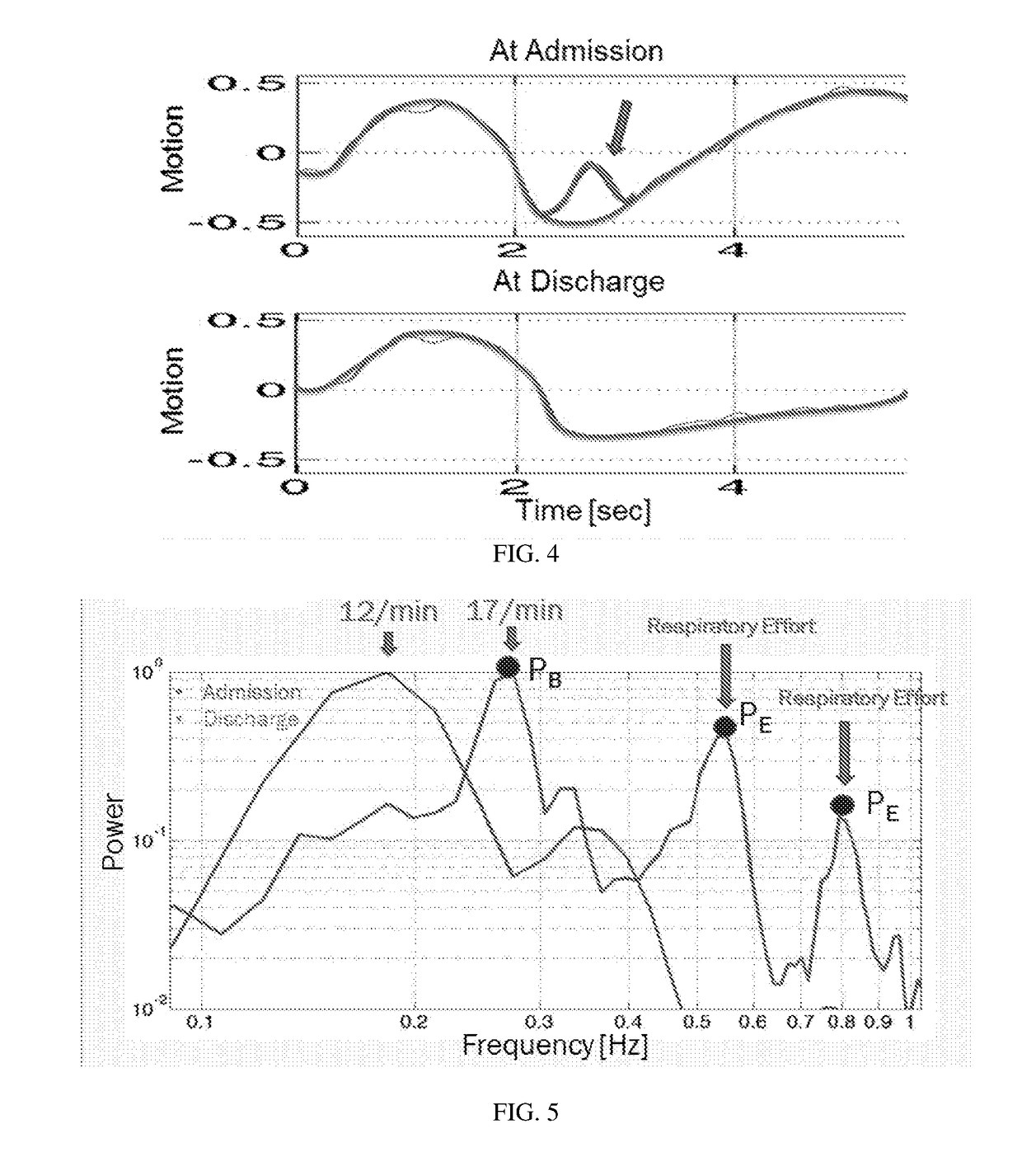 Method device and system for monitoring sub-clinical progression and regression of heart failure