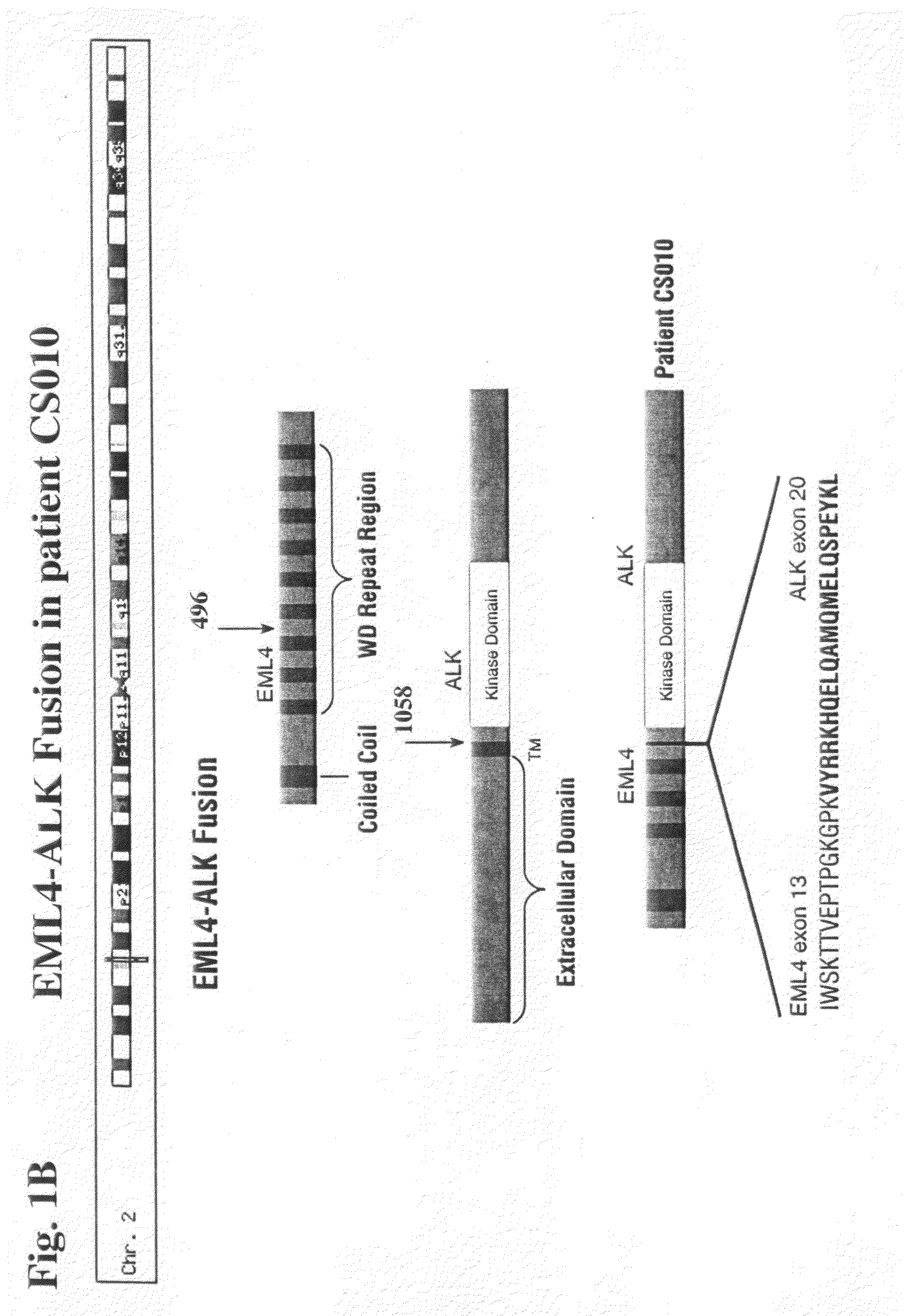 Gene defects and mutant ALK kinase in human solid tumors