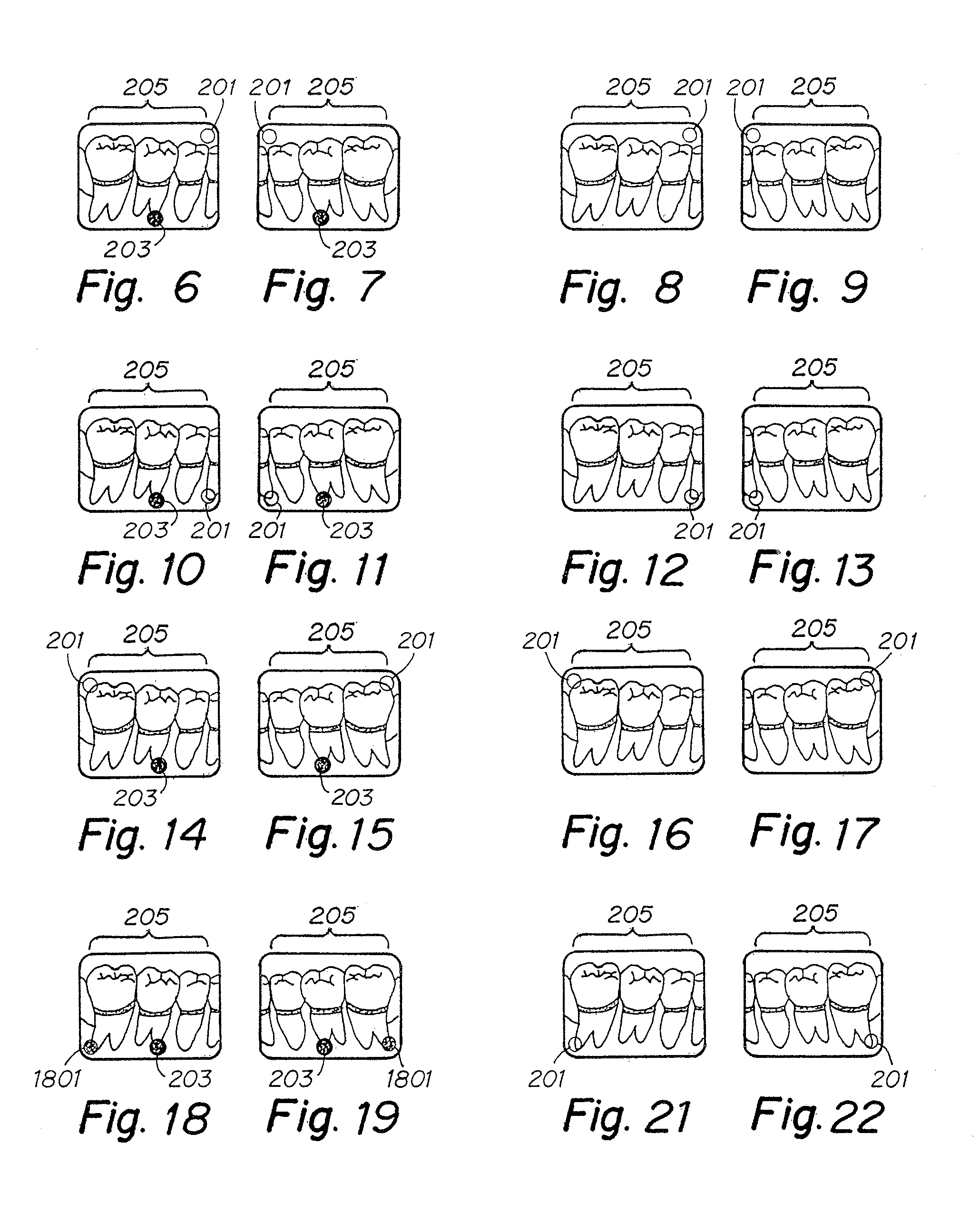 Radiation sensitive recording plate with orientation identifying marker, method of making, and of using same