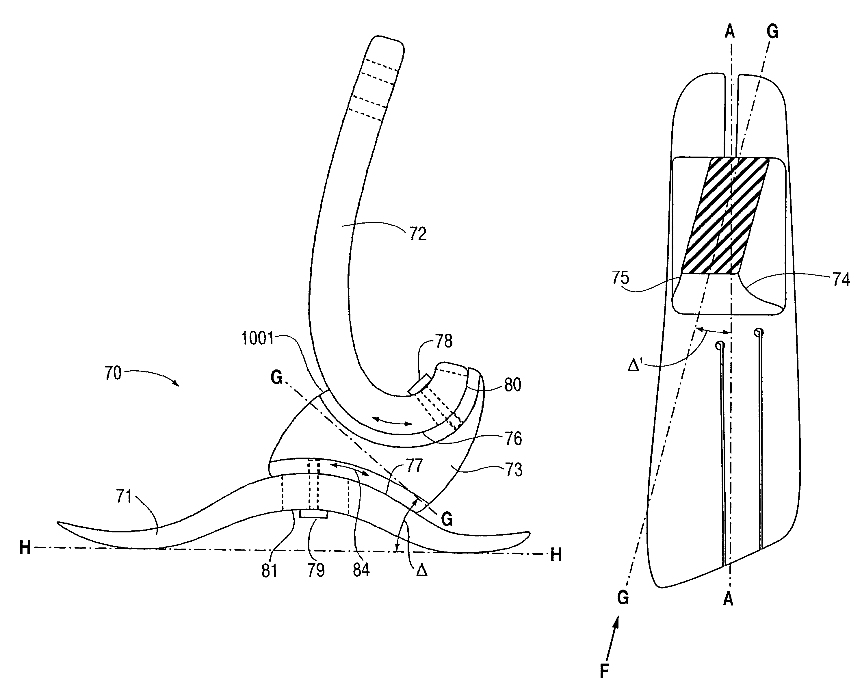 Prosthetic foot with tunable performance