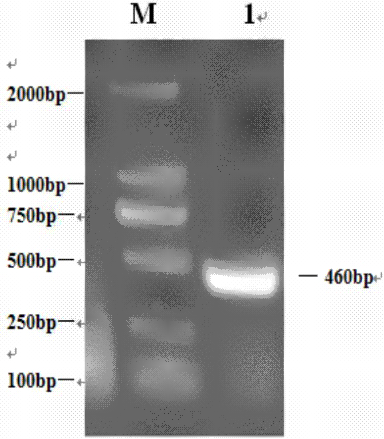 Dual real-time fluorescence quantitative PCR detection kit for foot-and-mouth disease and Seneca valley virus