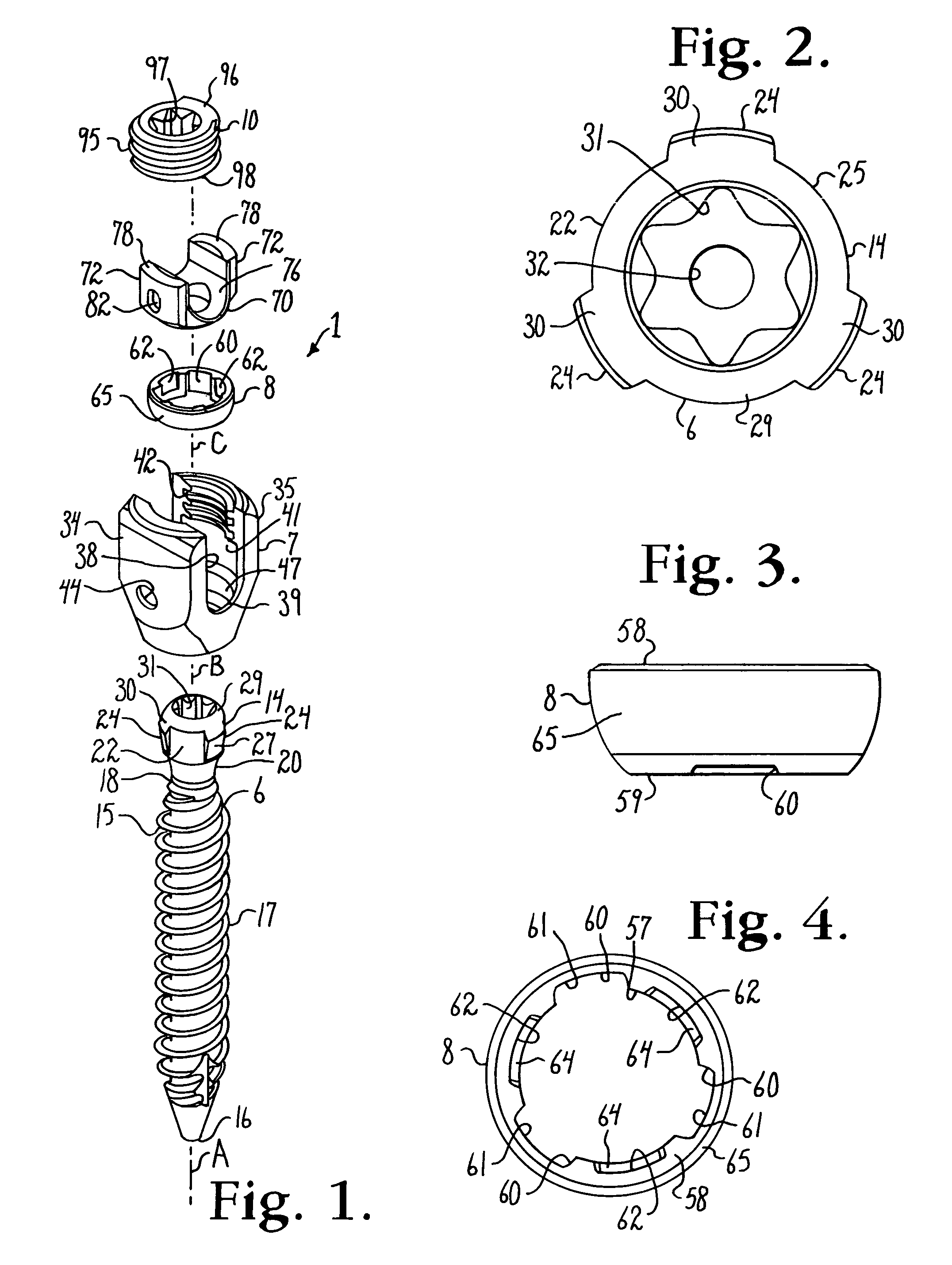 Polyaxial bone anchor with spline capture connection and lower pressure insert