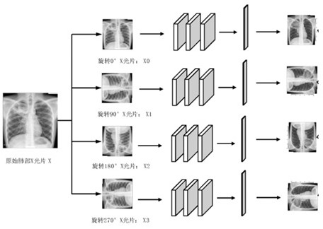 X-ray lung disease automatic positioning method based on weak supervised learning