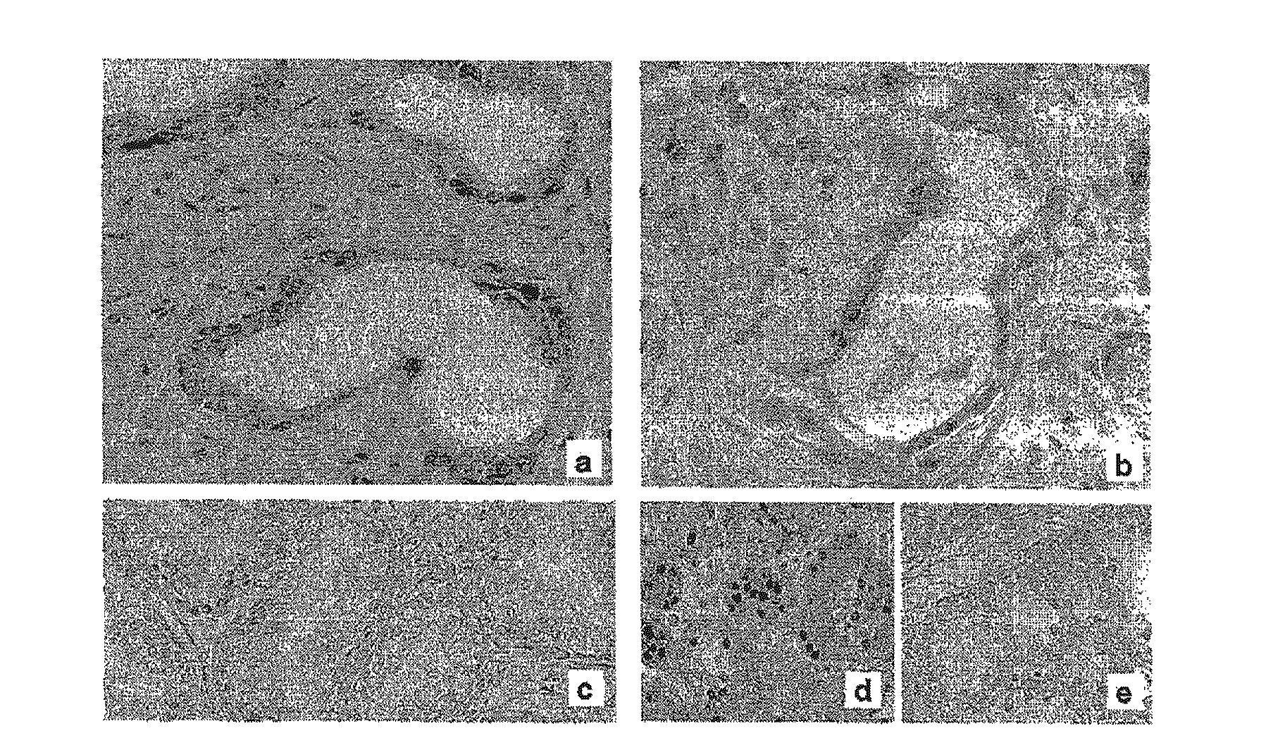 Methods and compositions for the inhibition of stat5 in prostate cancer cells