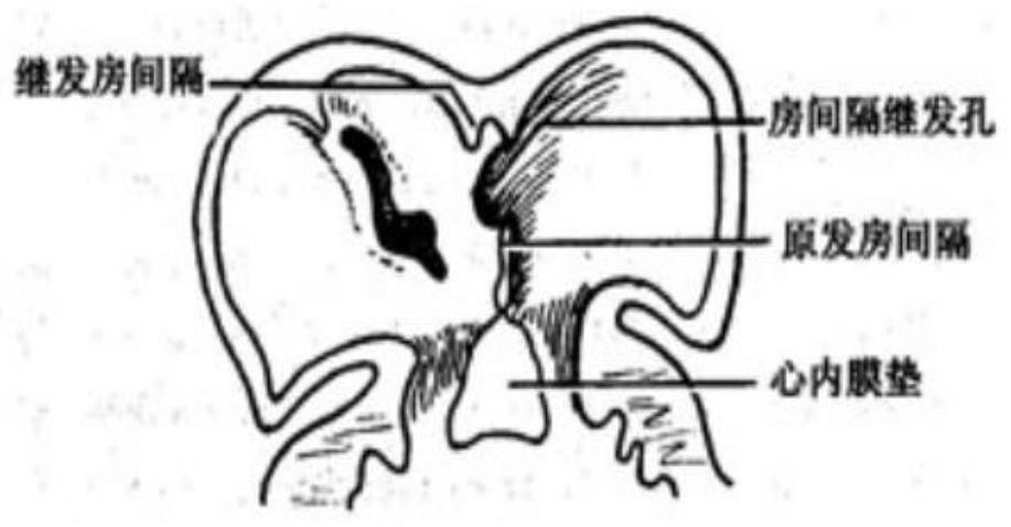 Device suitable for patent foramen ovale patient