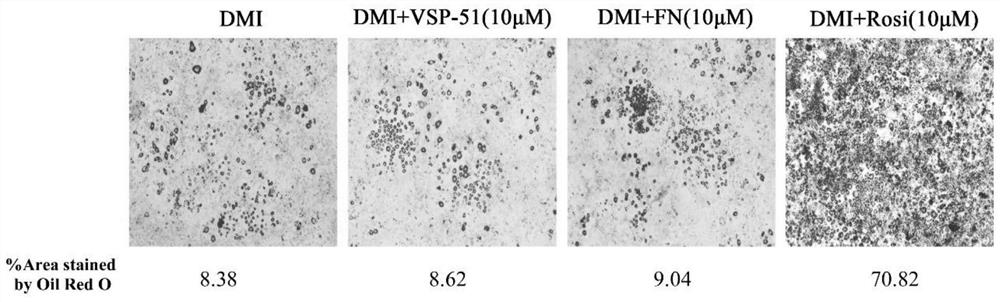 Application of fenticonazole nitrate to preparation of anti-diabetic drug