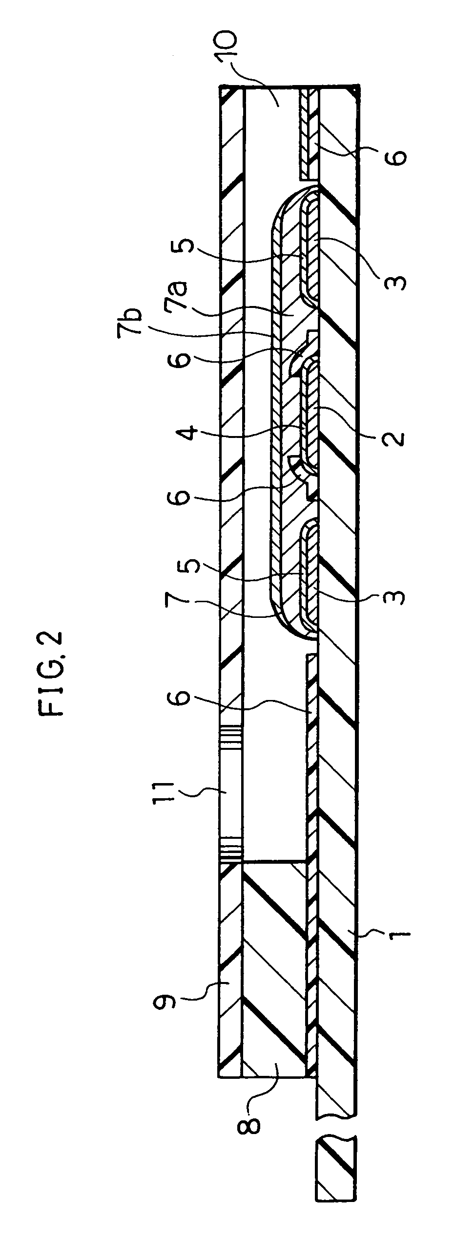 Glucose sensor