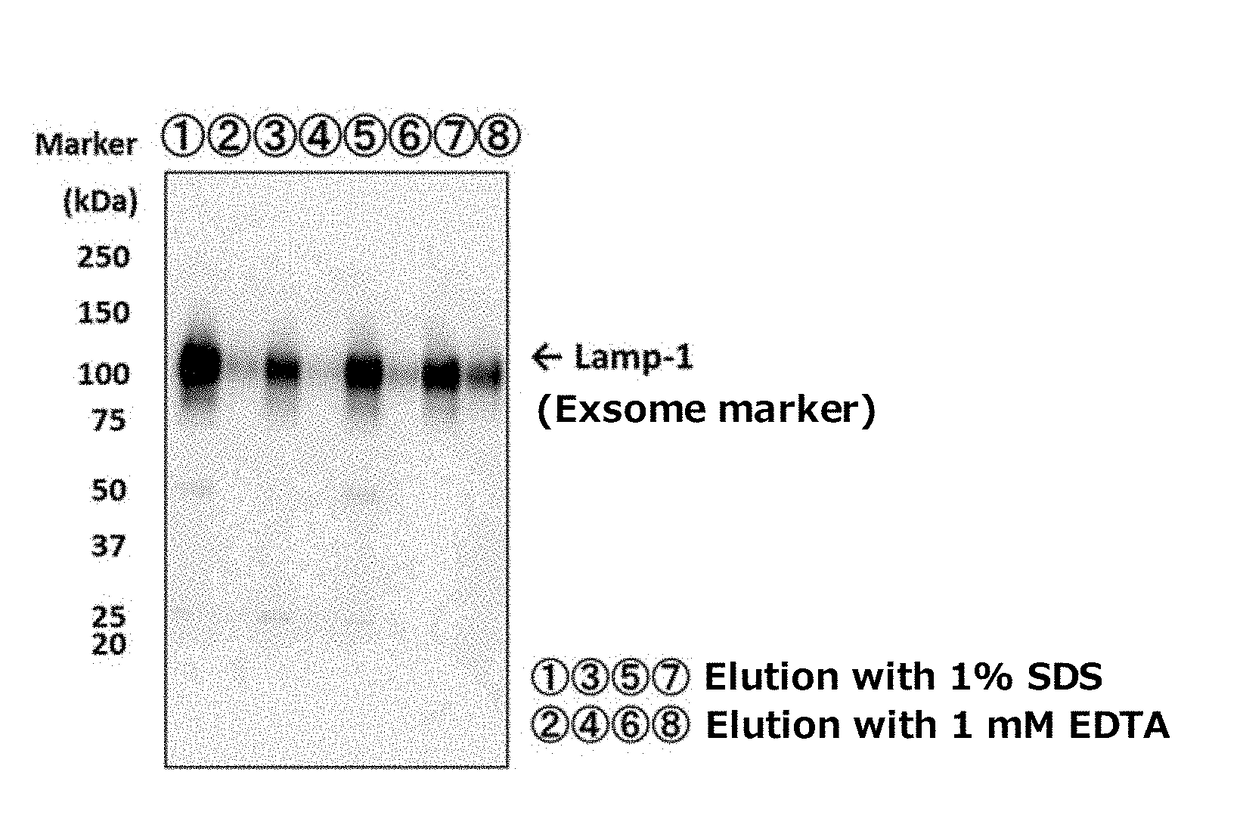 Tim protein-bound carrier, methods for obtaining, removing and detecting extracellular membrane vesicles and viruses using said carrier, and kit including said carrier