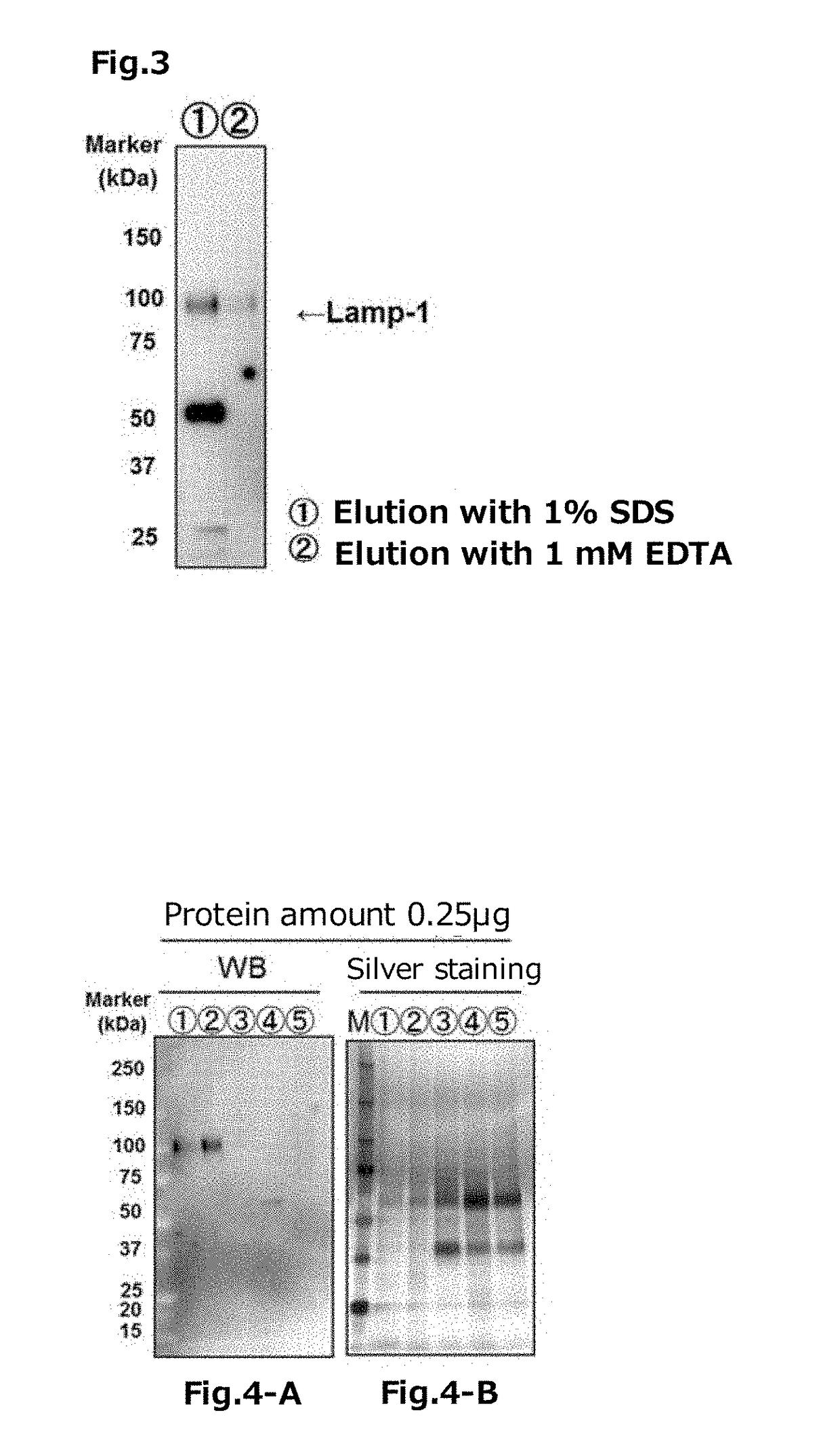 Tim protein-bound carrier, methods for obtaining, removing and detecting extracellular membrane vesicles and viruses using said carrier, and kit including said carrier