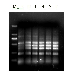 Multiple RT-PCR (reverse transcription-polymerase chain reaction) detection method for SPVD (sweet potato virus disease)