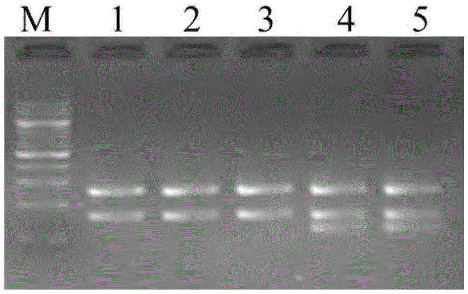 CYP3A5*3 detection kit