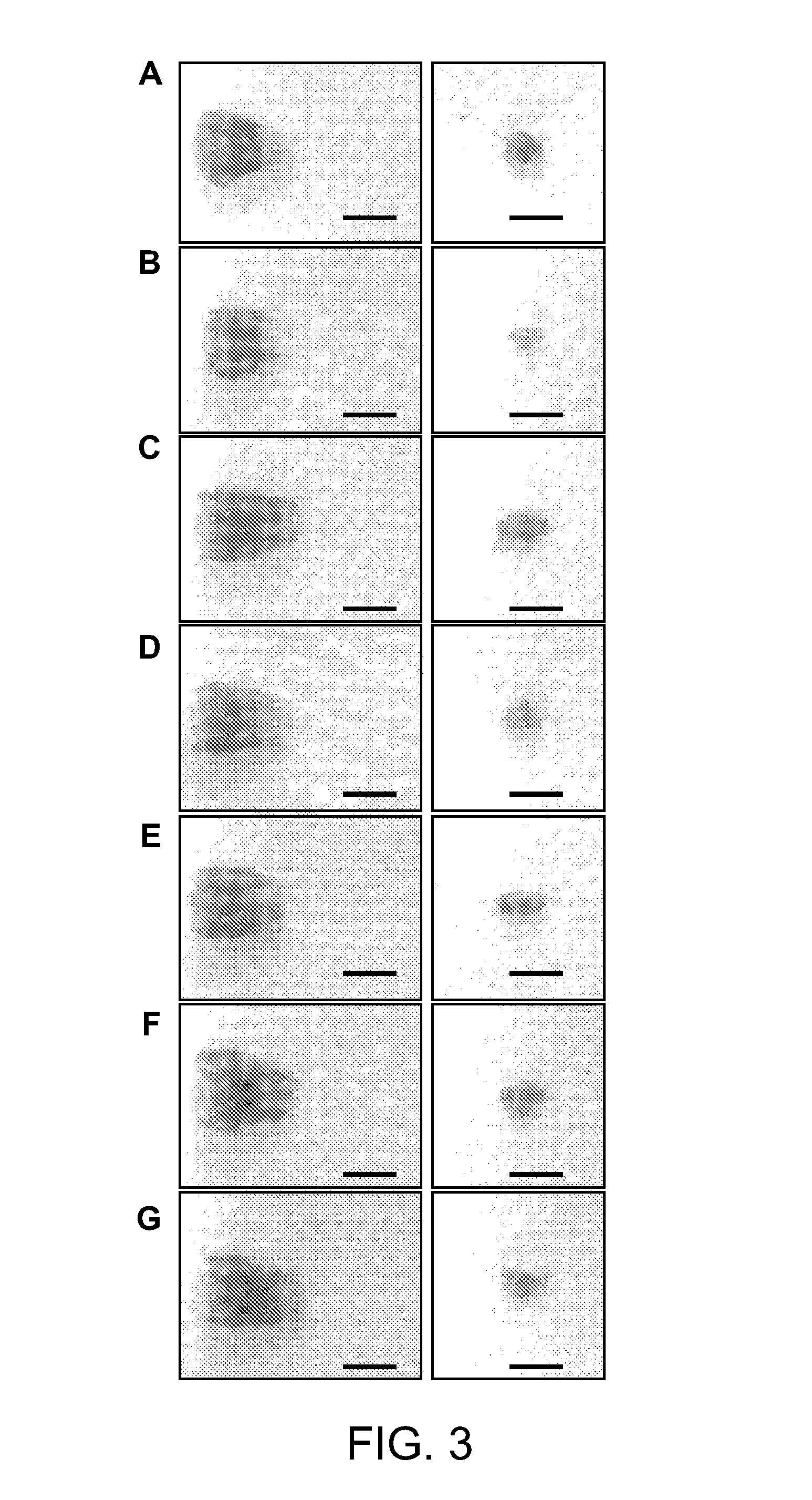 Pharmaceutical composition for preventing or treating thyroid diseases, containing lonicera caerulea l. var. edulis fruit extract as active ingredient