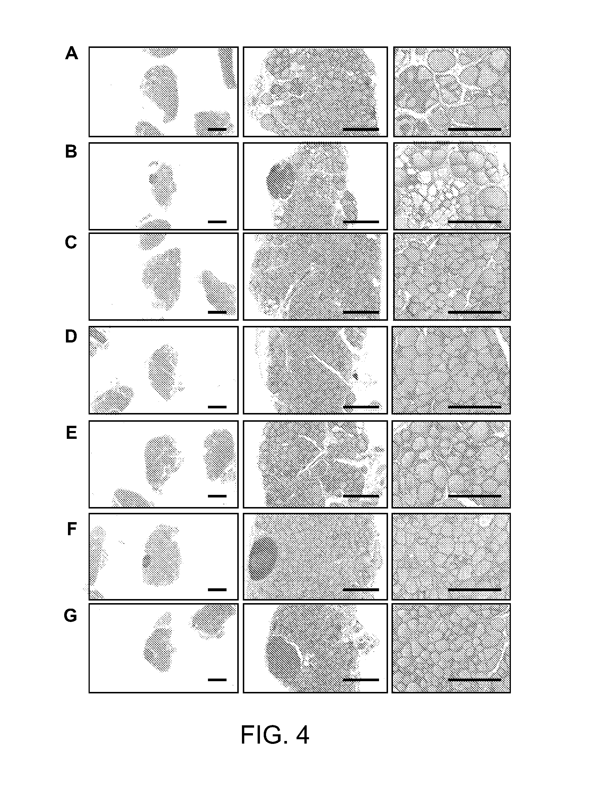 Pharmaceutical composition for preventing or treating thyroid diseases, containing lonicera caerulea l. var. edulis fruit extract as active ingredient