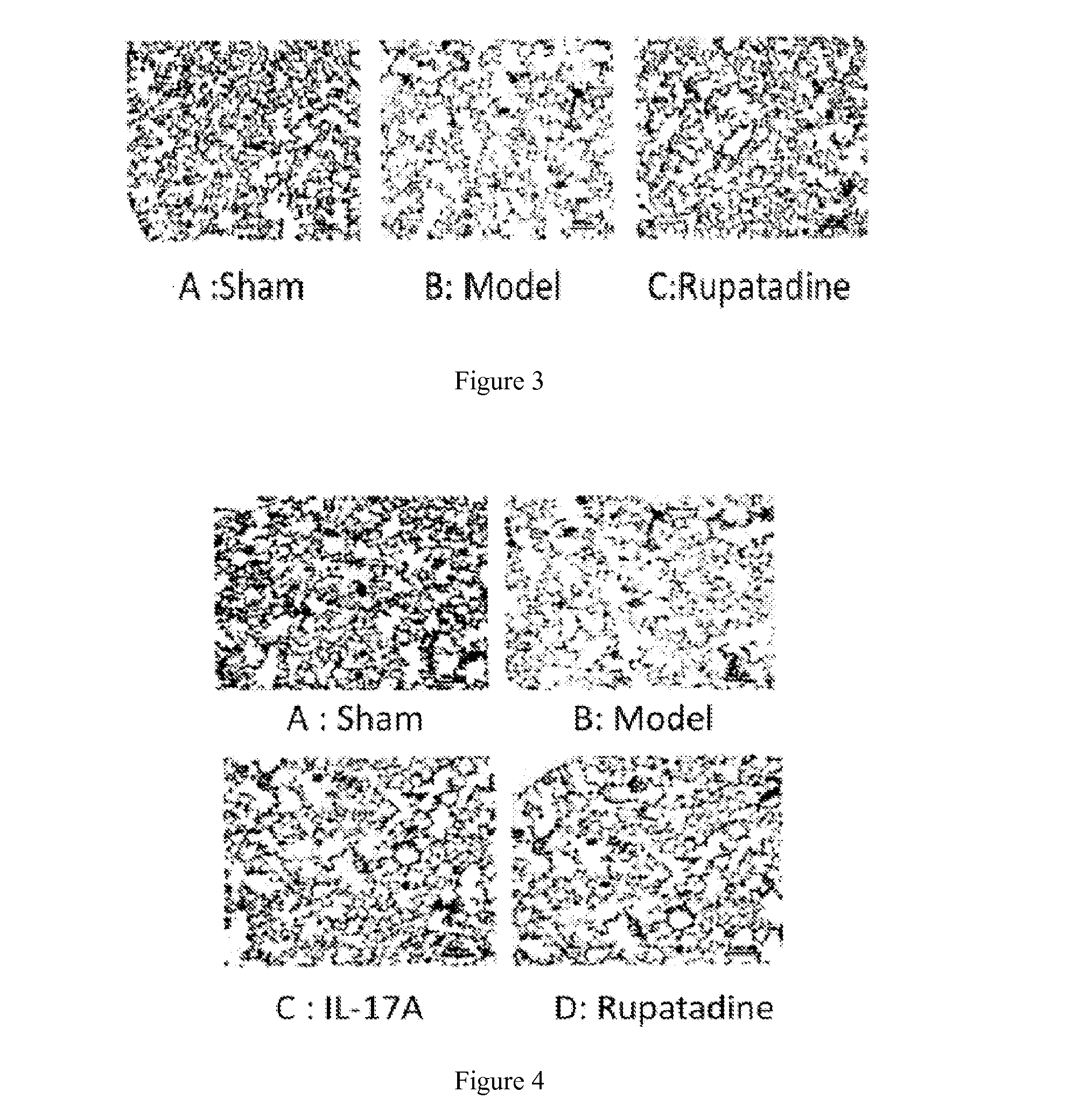 Use of Rupatadine in the Manufacture of Pharmaceutical Composition for Treating Chronic Obstructive Pulmonary Disease