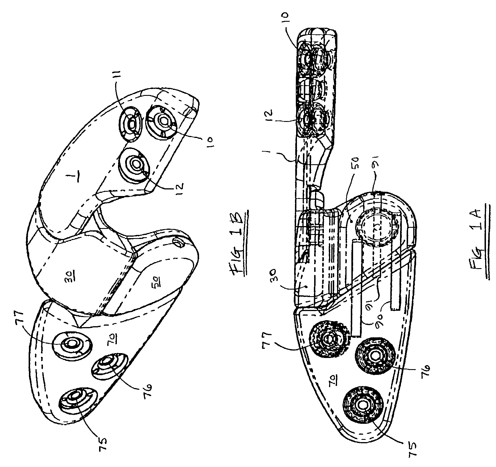 Apparatus for dynamic external fixation of distal radius and wrist fractures