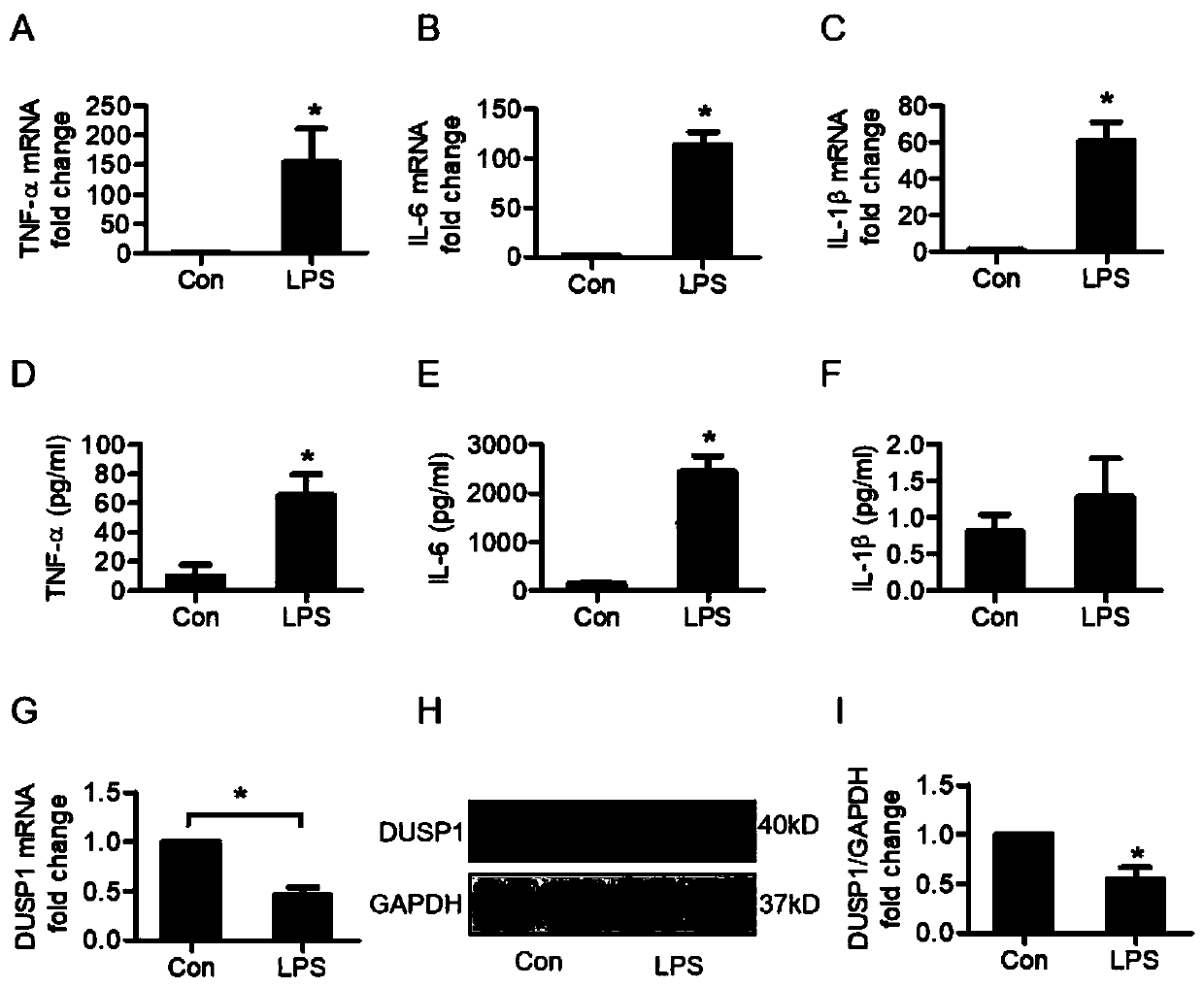 Application of rolipram in preparation of medicines for treating sepsis cardiac dysfunction