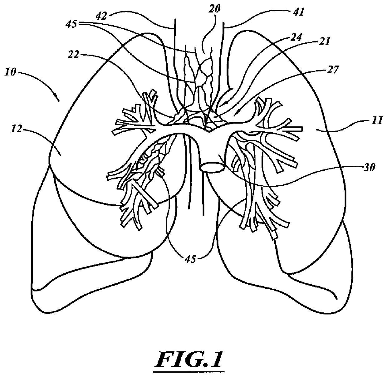 Systems, devices, and methods for treating a pulmonary disorder with an agent