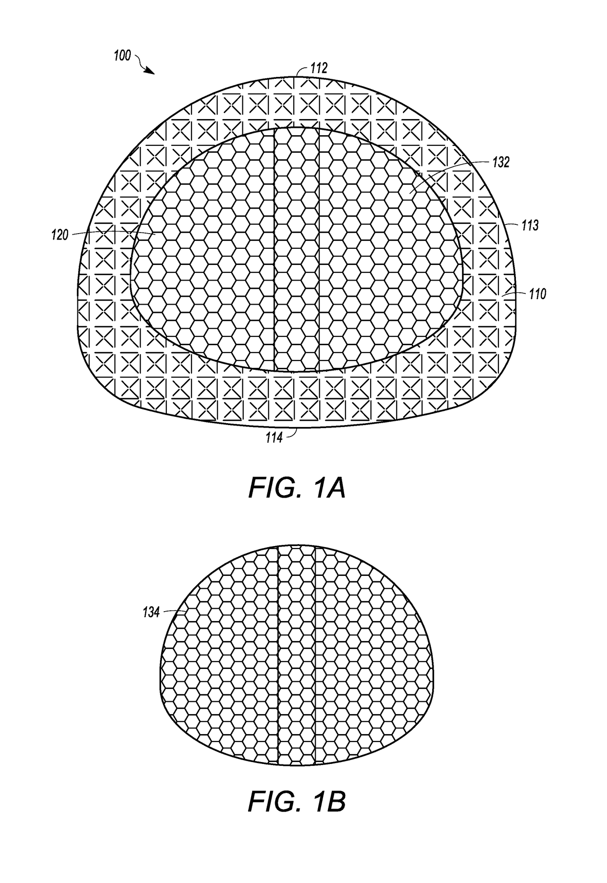 Interbody cage with spill-free biological material compartment