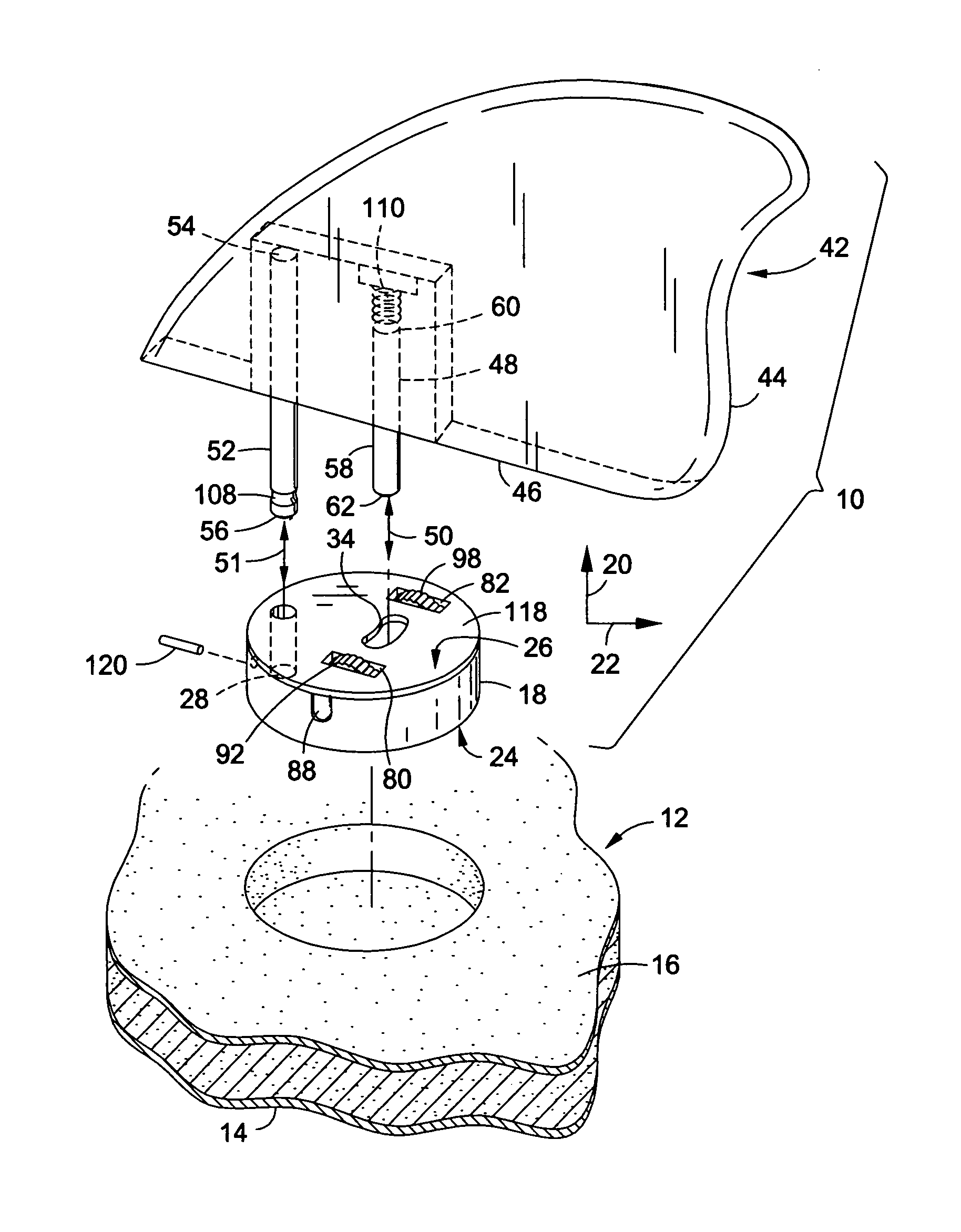 Pivotal surfboard fin assembly