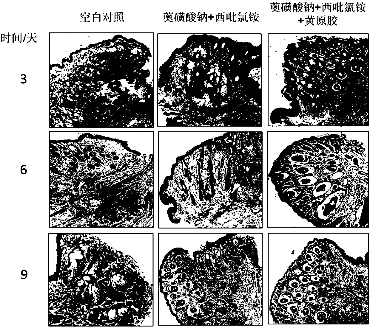 Preparation and application of sodium allylsulfonate (SAS) and cetylpyridinium chloride(CPC) compound gel