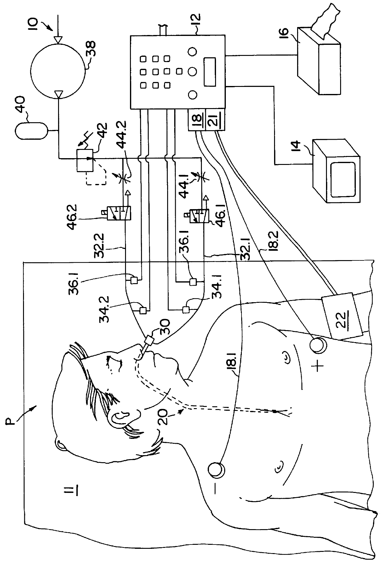 Method and apparatus for noninvasive determination of cardiac performance parameters