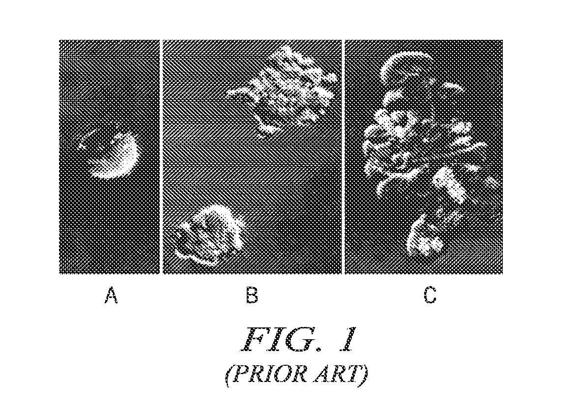 Intertumoral homogeneity determined by mick assay