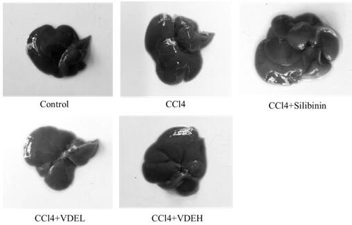 Application of vaccinium dunalianum wight or extract thereof in preparation of medicines or health-care products for preventing and treating hepatic fibrosis