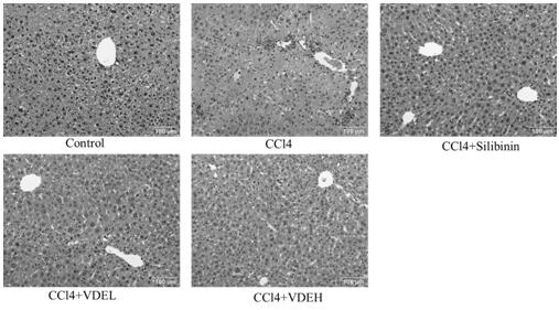 Application of vaccinium dunalianum wight or extract thereof in preparation of medicines or health-care products for preventing and treating hepatic fibrosis