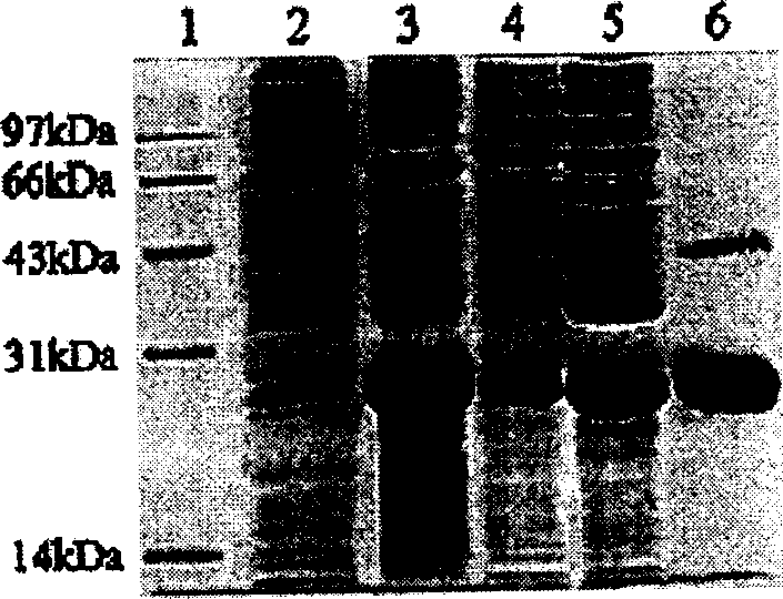 Construction, expression and purification method of recombinant human parathyroid hormone in colibacillus