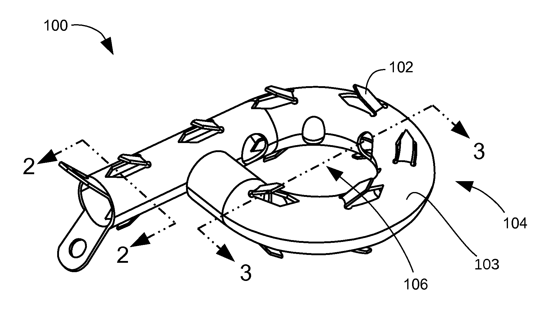 Memory material implant system and methods of use