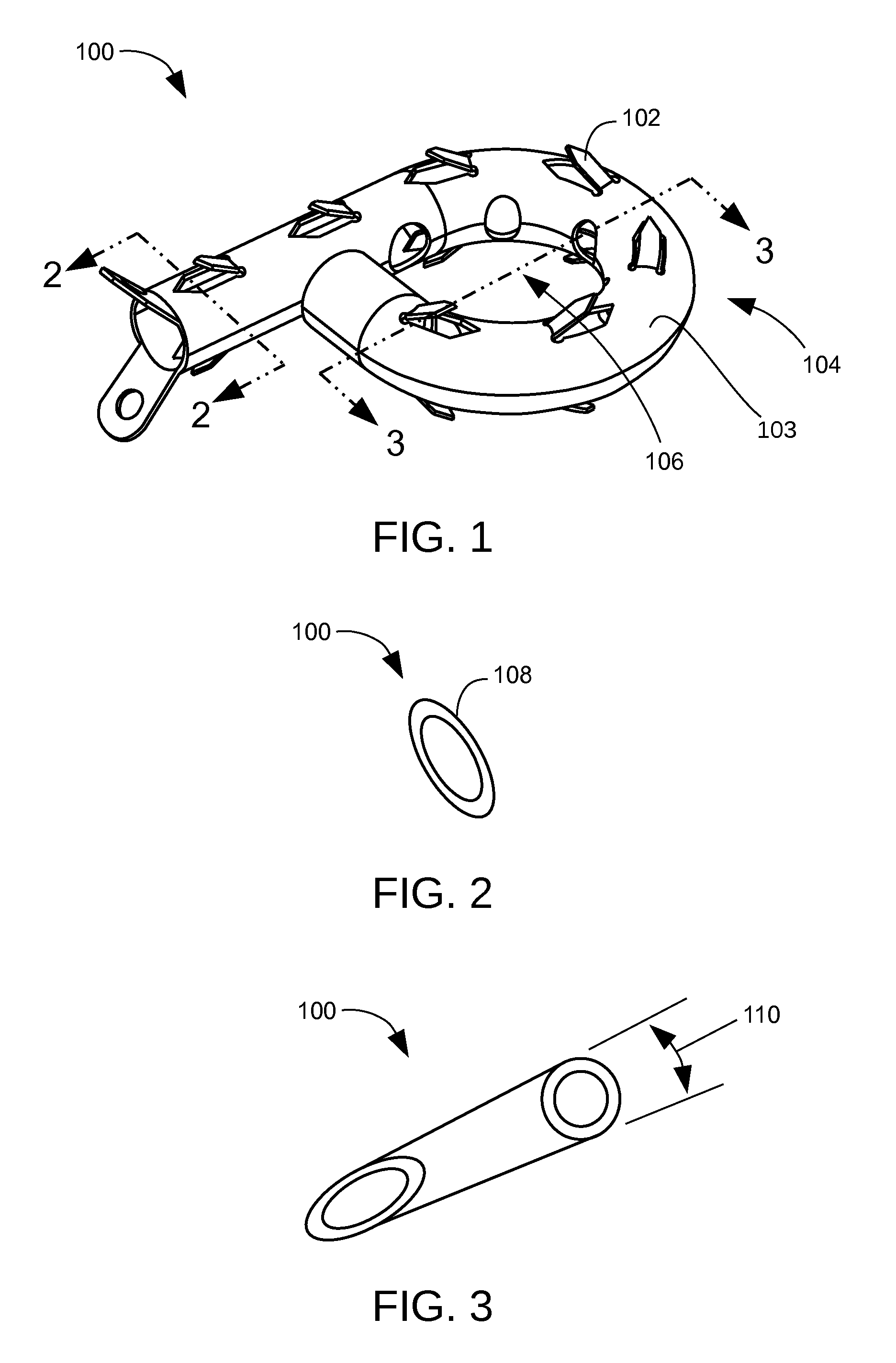 Memory material implant system and methods of use