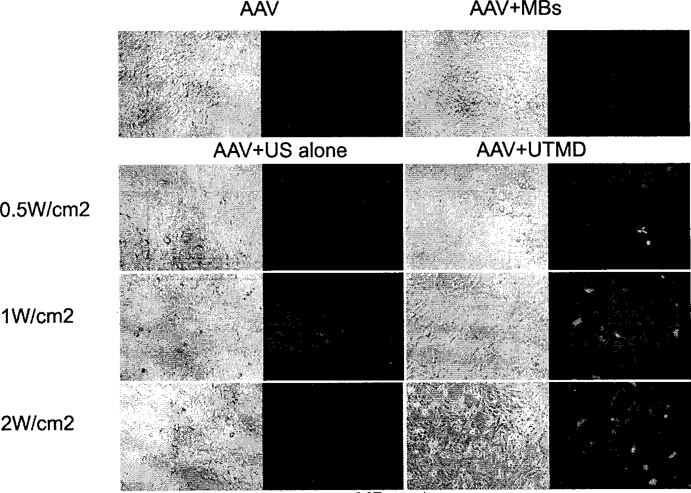 Method for mediated gene transfection