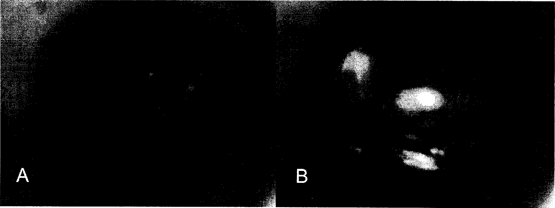 Method for mediated gene transfection