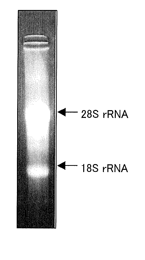 Novel protein capable of binding to hyaluronic acid, and method for measurement of hyaluronic acid using the same