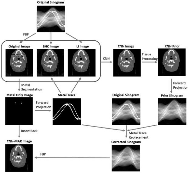 CT image metal artifact removing method and device and computer readable storage medium