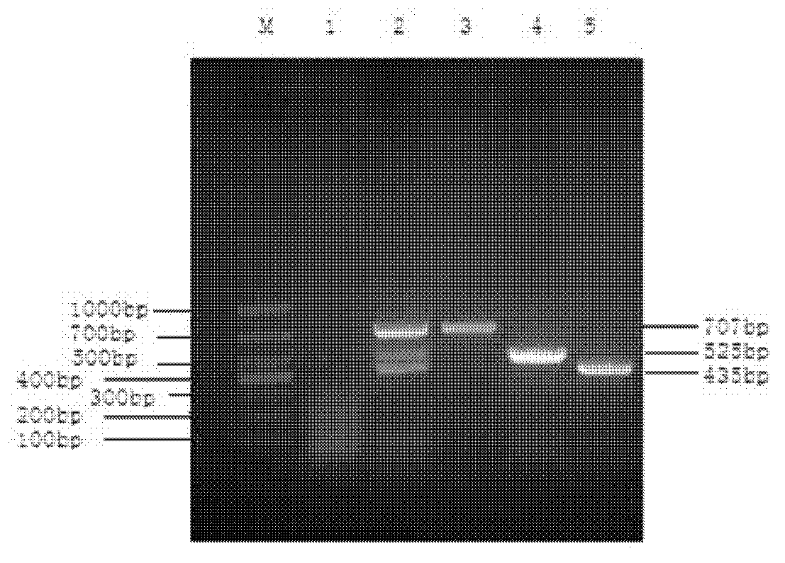 Reverse transcription-polymerase chain reaction (RT-PCR) detection for porcine reproductive and respiratory syndrome virus and classical swine fever virus and special primers for same