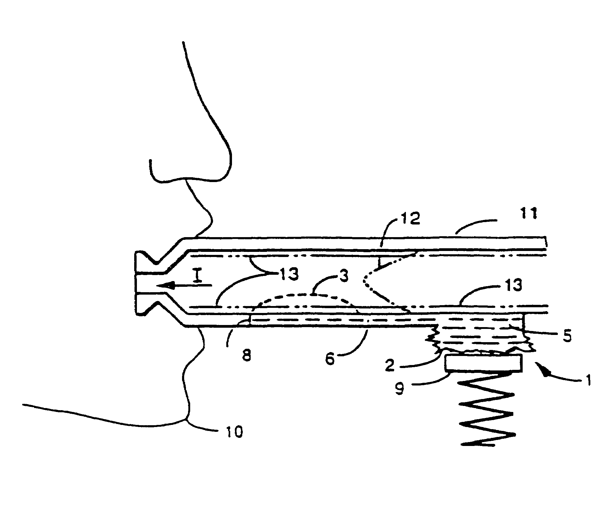 Method of treating diabetes mellitus in a patient