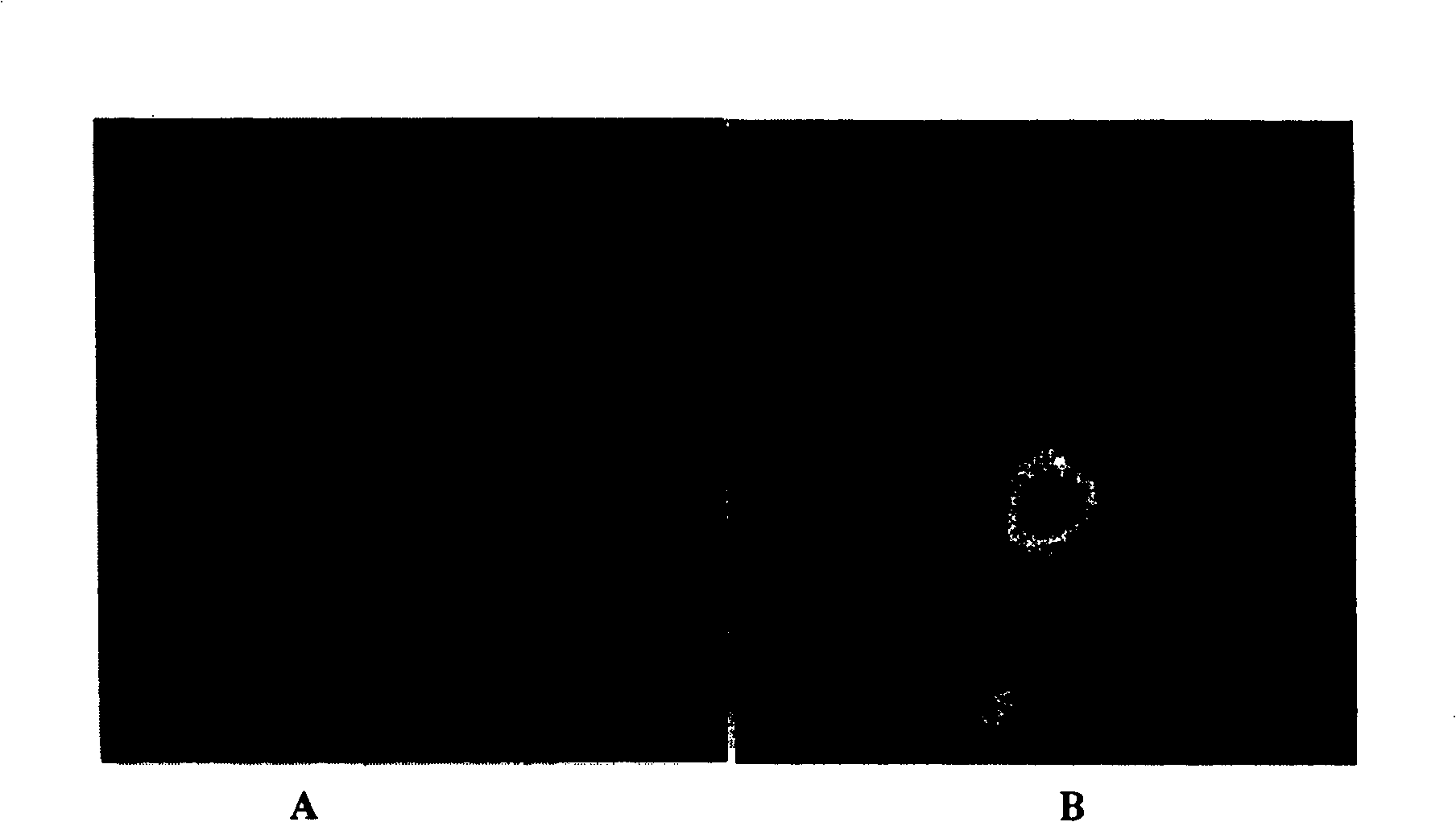 Method for preparing nano liver-target biodegradating medicine carrier material