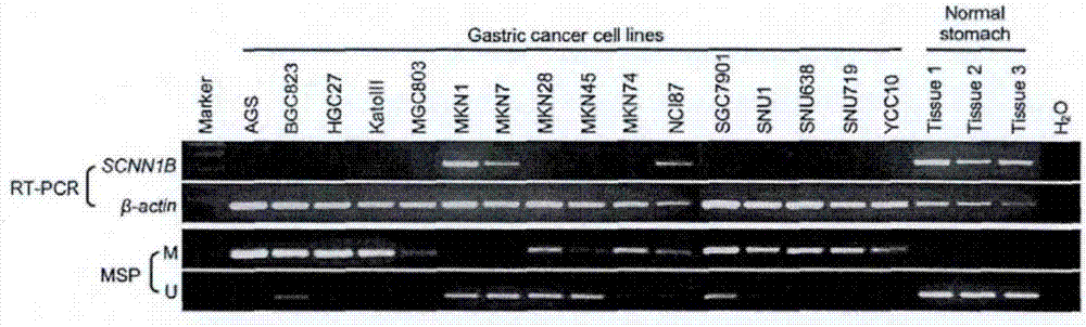 Chip and kit for cancer diagnosis