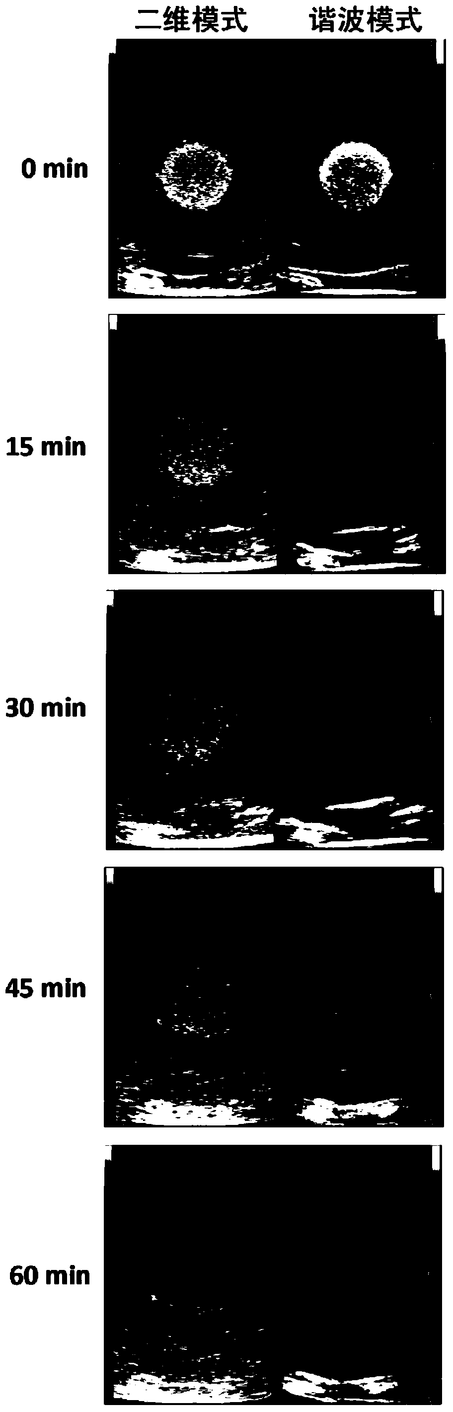 A phantom model simulating the performance of tumor contrast-enhanced ultrasonography for tumor diagnosis and treatment research