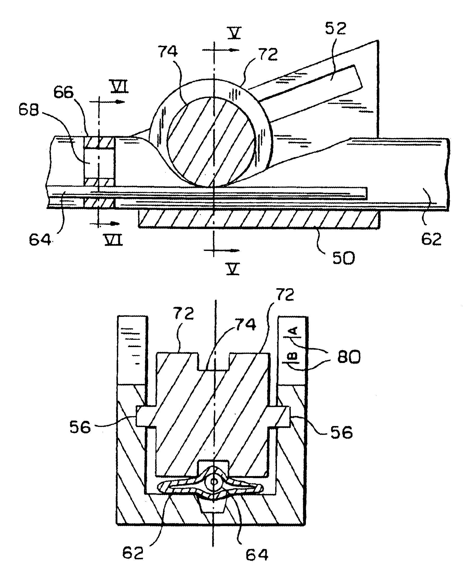 Hemodialysis system