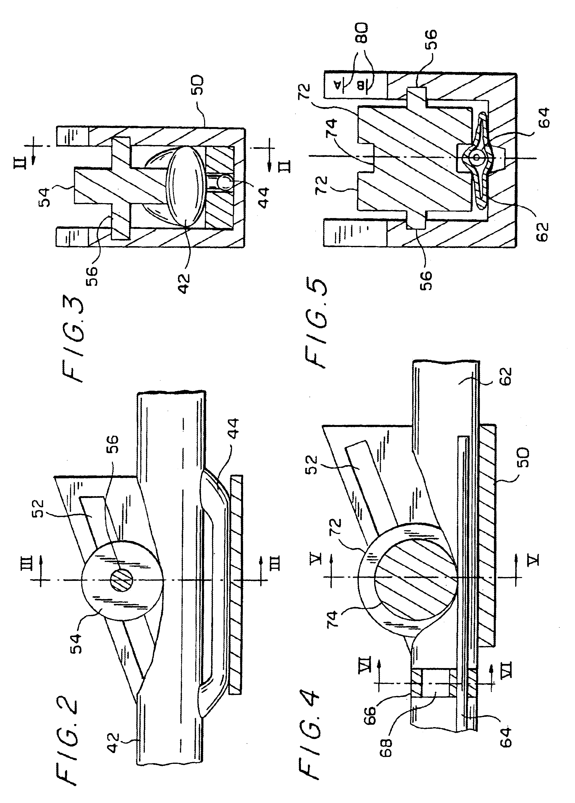 Hemodialysis system