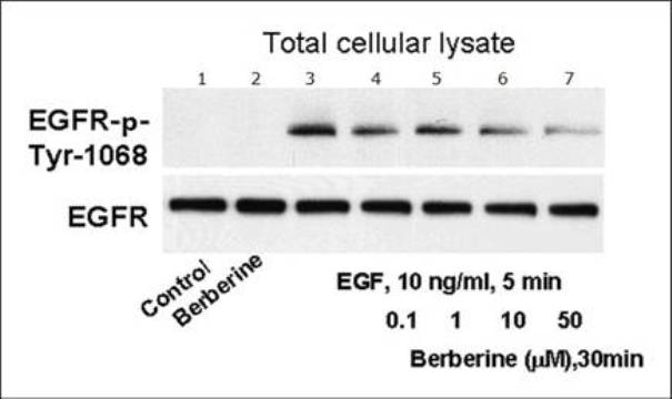 Application of berberine to preparing drug for preventing and treating familial adenomatous polyp