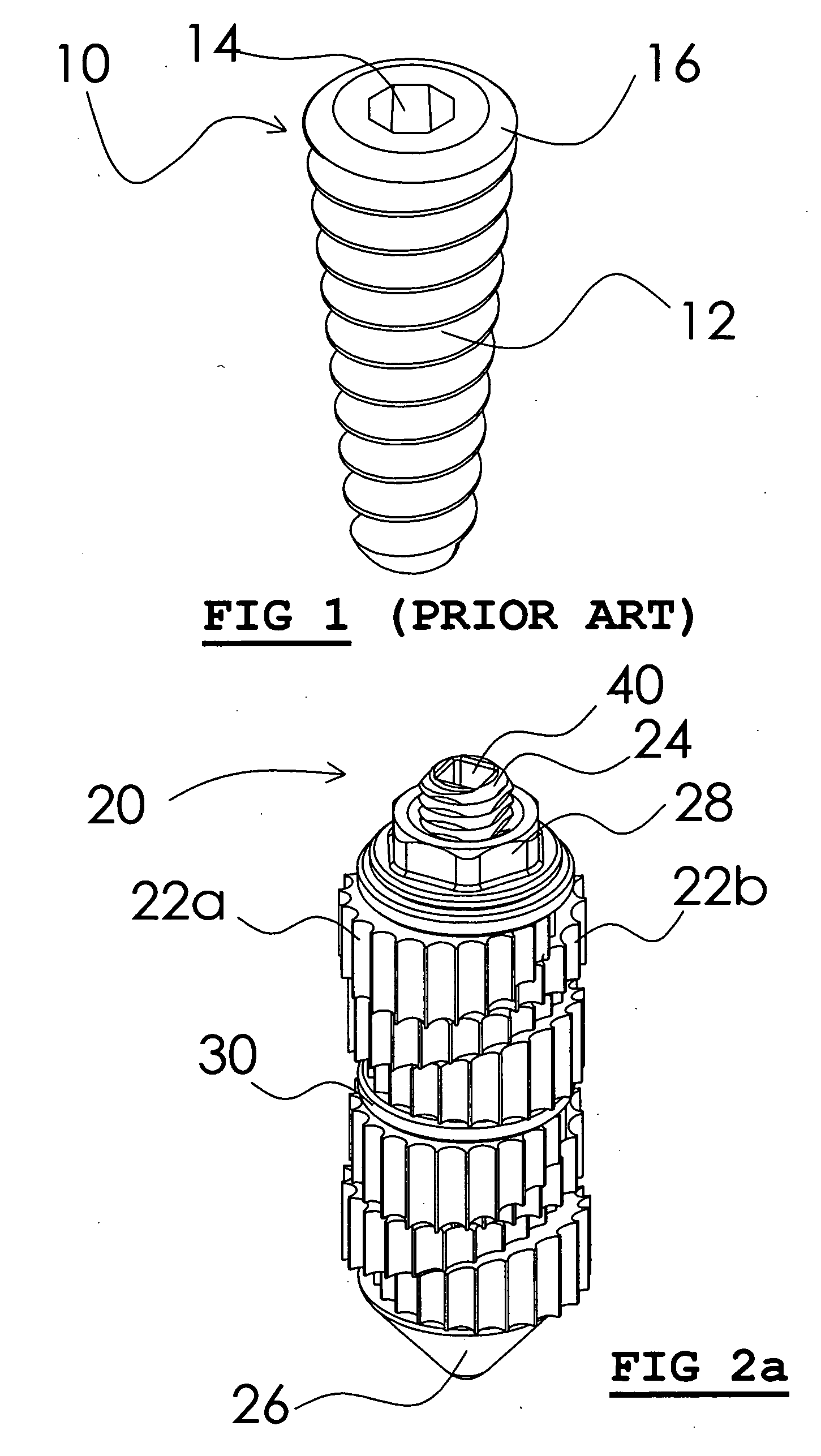 Shape-changing anatomical anchor