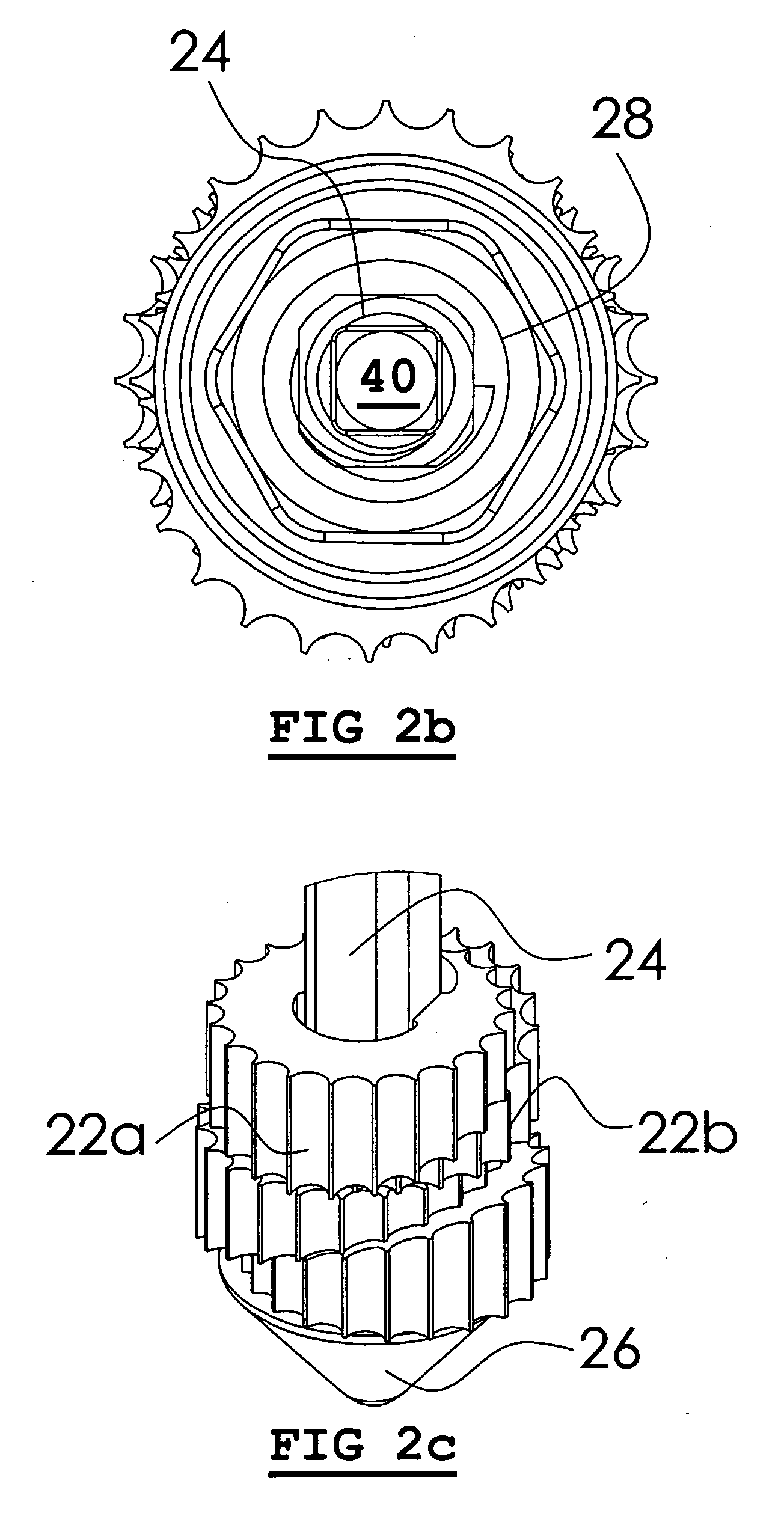 Shape-changing anatomical anchor