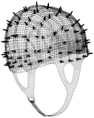 Transcranial direct-current stimulation intelligent equipment