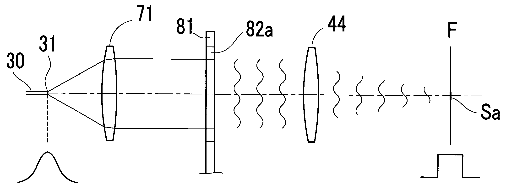 Ophthalmic laser treatment apparatus