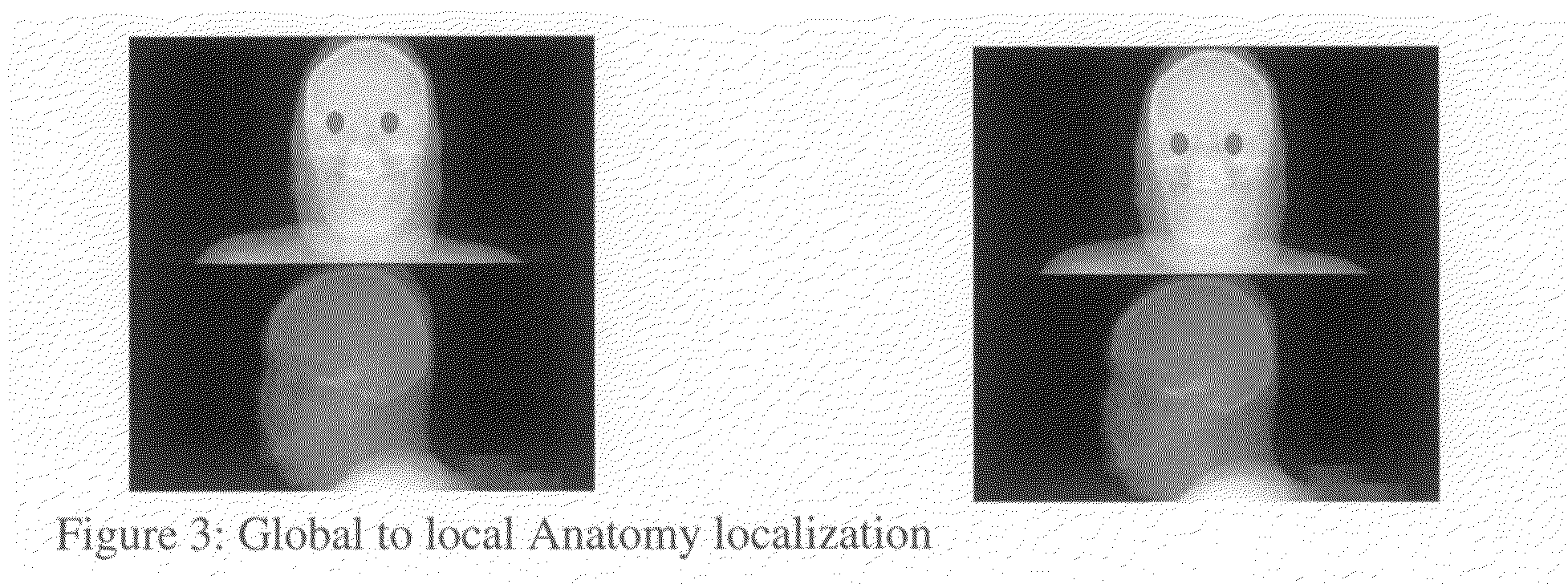 System and method for automated patient anatomy localization