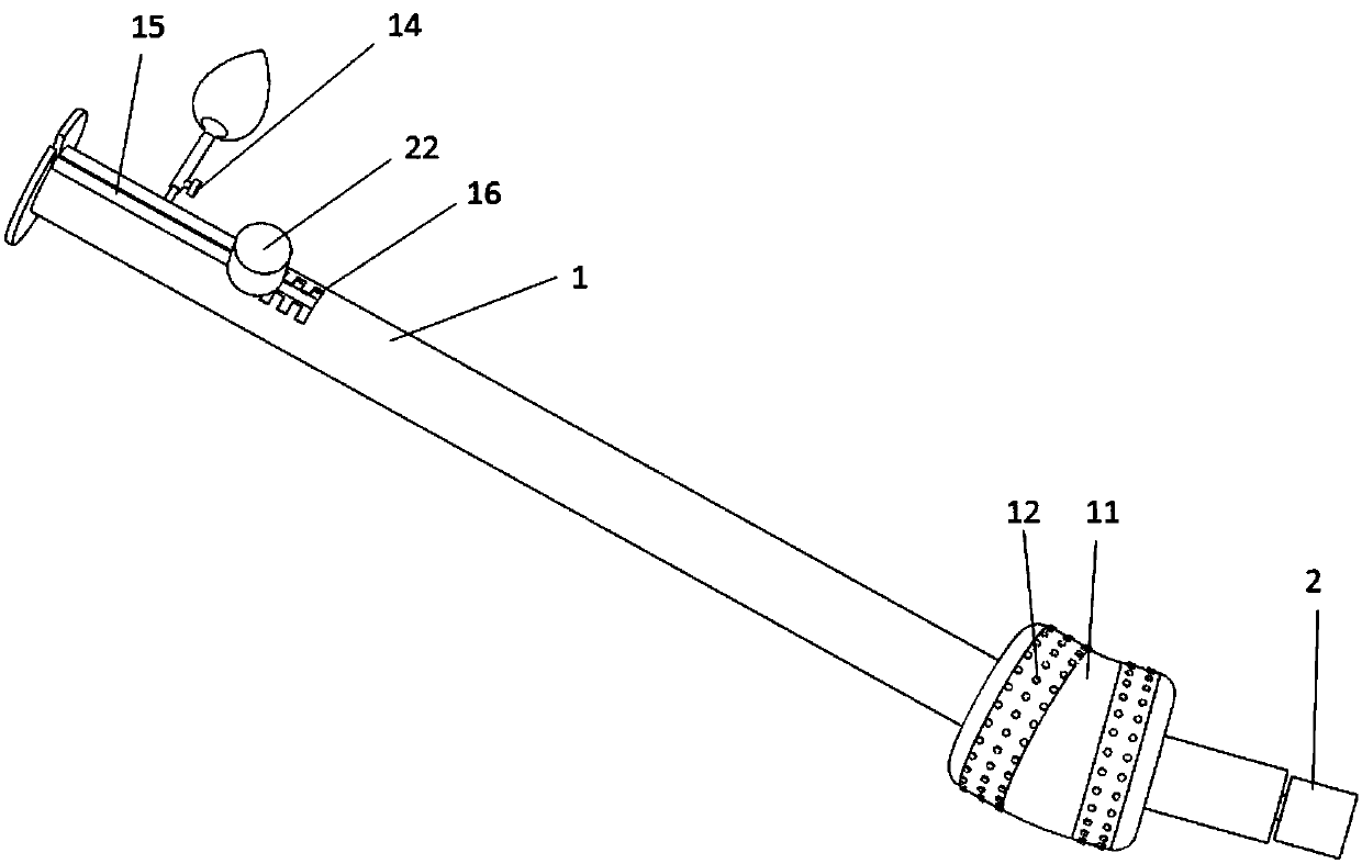 Vesicoureteral reconstruction anastomosis assistor for radical operation of bladder cancer and prostate cancer